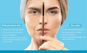 تفاوت-پوست-دهیدراته-و-پوست-خشک-در-یک-نگاه