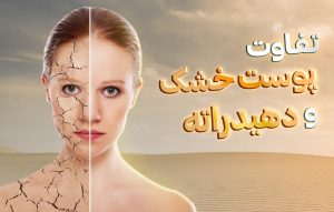 درمان-پوست-دهیدراته-با-سرم-هیالورونیک-و-کرم-مرطوب-کننده-قوی