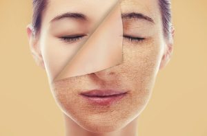 علل-کم-آبی-پوست-دهیدراته-شدن-عوامل-داخلی-و-محیطی